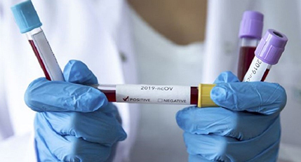 Çin’de Kovid-19 aşılarının Nisan’da klinik deneylere başlaması planlanıyor