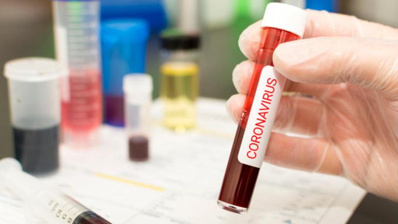 Koronavirüs: ABD’de 6 yeni ölüm yaşandı
