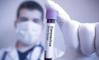 ABD’de koronavirüsten ölenlerin sayısı 81 bin 937’ye yükseldi