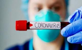 Güney Kıbrıs’ta bugün 3 yeni koronavirüs vakası açıklandı