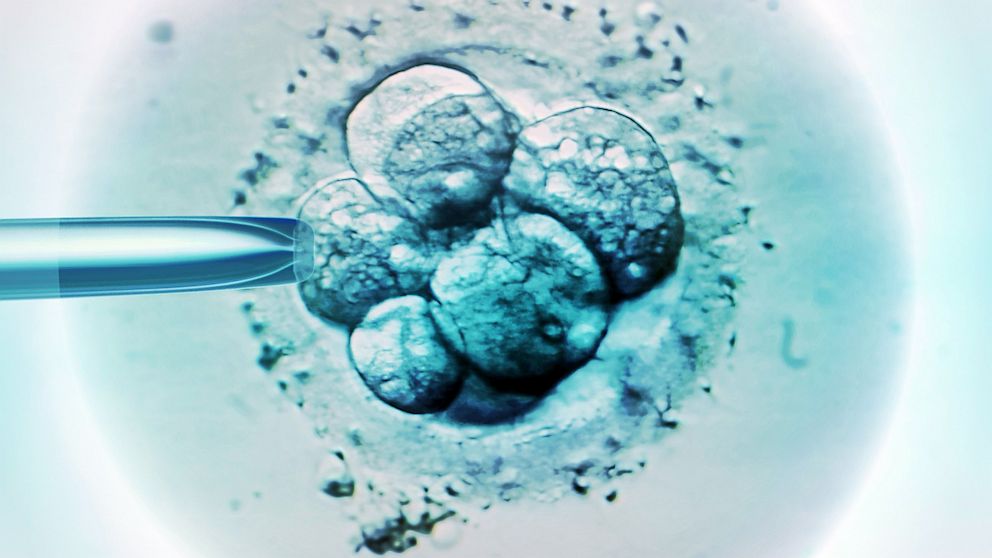 Dondurulan embriyoyla çocuk sahibi oldular!