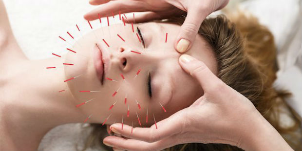 Akupunkturla Şeker Tedavisi Mümkün Mü?